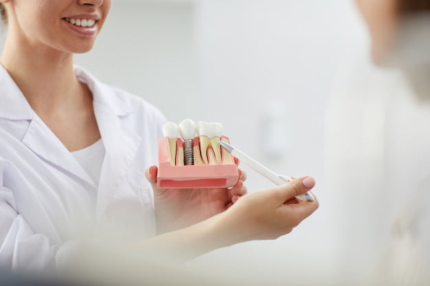 Four Reasons to Consider Dental Implants